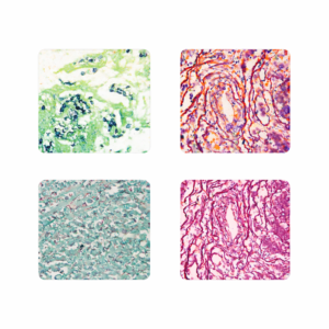 Coloraciones Especiales