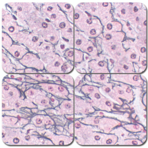 reticulum stain kit – chandler’s precision