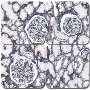 ones basement membrane reticulum kit
