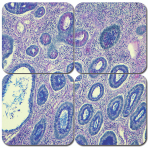 alcian blue pas stain kit