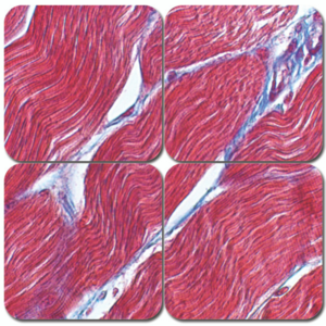 trichrome stain kit – masson’s