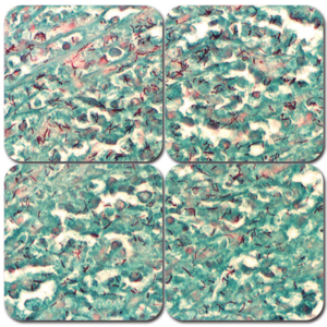 AFB Stain Kit (Acid-Fast Bacteria)