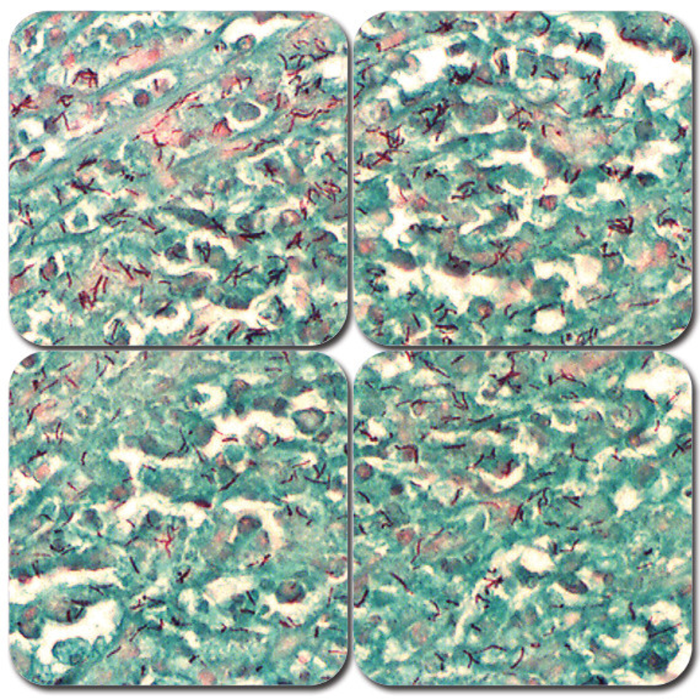 AFB Stain Kit (Acid-Fast Bacteria)