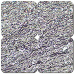 elastic stain kit – verhoeff’s