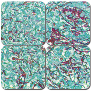 pas stain kit (periodic acid schiff)
